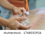 Small photo of It's a photo about bonesetters and suction cups medecin