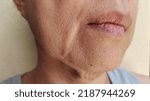 Small photo of portrait showing the flabbiness adipose sagging skin on the face, cellulite under the eyes, blemishes and dark spots, problem wrinkled and flabby skin of the Middle-aged woman, concept health care.