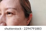 Small photo of portrait the flabbiness and wrinkle, ptosis and flabby skin beside the eyelid, dull skin and dark spots on the cheek, freckles and blemish on the face of the woman, health care and beauty concept.