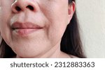 Small photo of portrait the flabbiness and wrinkle beside the mouth, smile lines and flabby skin corner the lip , blemish and dark spots, wrinkles skin on the face of the woman, health care and beauty concept.