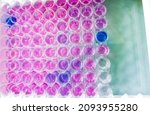 Small photo of Enzyme-linked Immunosorbent assay (ELISA) plate, Anti HCV test, TPHA test, HBsAg test, show some positive result, close view