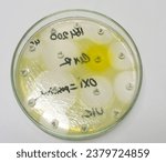 Small photo of Antimicrobial susceptibility testing, Pseudomonas aeruginosa in culture plate. Drug sensitivity test, disk drug, antibiotic sensitivity, Nitrofurantoin resistance.