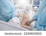 Small photo of Surgeon in medical gown in operating room inserts a catheter into vein on patient's lower limb to treat varicose veins. Surgical treatment of varicose veins in hospital by a team of vascular surgeons