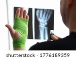 Small photo of Close-up of male hand in green ace bandage. Person showing fracture bone and holding x ray image of human wrist. Accident recovery and modern medicine concept
