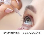 Woman drips eye drops into her eyes. Eye diseases and their treatment concept