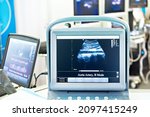 Screen of a portable medical ultrasound machine