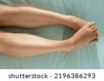 Small photo of Woman's legs with dry skin that is ashamed. Feet that tighten in a position of embarrassment.
