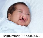 Small photo of Hoping her cries dont go unheard. Closeup shot of a baby girl with a cleft palate.