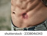 Small photo of Paintball injury, stomach bruise and man in closeup with pain, shooting or accident for outdoor war games. Abdomen, emergency and wound in military training, zoom and battlefield for exercise in army