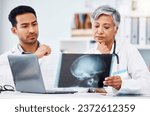 Small photo of Doctor, healthcare and skull xray analysis, collaboration and laptop with neuro and assessment of scan. Head injury, radiology and people on surgeon team, review picture with anatomy in hospital