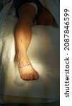 Small photo of foot surgery tibial transposition. metatarsophalangeal joint fusion