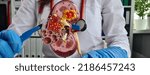 Small photo of Surgery of kidneys and adrenal glands is medical surgical intervention. Doctor holds in one hand model of kidney with ureter and scalpel surgical operation to treat or remove