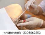 Small photo of The gynecologist takes a vaginal swab for bacterial examination. Gynecological chair. A woman at the gynecologist for a check-up.