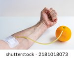 Small photo of Transfusion of vitamin C from an orange to an arm. Concept on the benefits of vitamin C fruit intake.