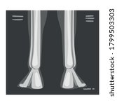 roentgenograph of lower leg... | Shutterstock .eps vector #1799503303