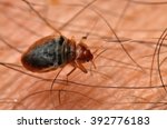Small photo of Bed bug Cimex lectularius on human skin.