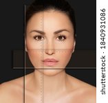 Small photo of Making Beauty, modifying face to make it closer to the Golden Mask,plastic surgery. correction of asymmetry.