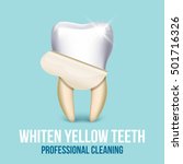 Tooth Veneer Whitening Dental...