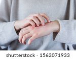 Small photo of Closeup girl is scratching her hand with nails. Reddened, inflamed body parts causes discomfort and itching. Young woman is suffering from bouts of allergies. Dermatological skin diseases concept.