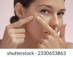 Small photo of Skin problem. Depressed woman touching pimple on face looking at mirror. Facial skin issues, medical care, and treatment concept. Selective Focus. High-quality photo