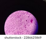 Small photo of Gram negative bacilli under light microscope ( 40X)