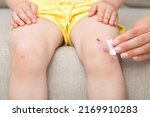 Small photo of Mother fingers applying medical ointment on abrasion knee skin of toddler. Child sitting on sofa and getting treatment at home. Closeup. Front view.