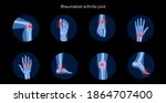 rheumatoid arthritis  pain ... | Shutterstock .eps vector #1864707400