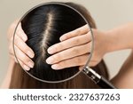 Small photo of Enlarge a woman's scalp with a magnifying glass.