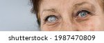 Old Woman  Sick Eye Detail...