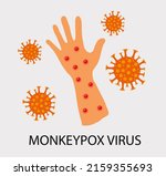Monkeypox Virus Zoonotic Viral...