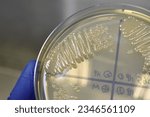 Small photo of Unidentified bacteria colonies on tsa agar. white round colonies.