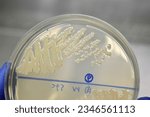 Small photo of Unidentified bacteria colonies on tsa agar. white round colonies.