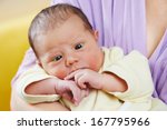 Small photo of inborn squint phenomenon of newborn baby