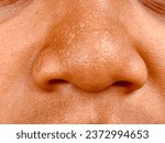 Small photo of Semarang, October 10 2023, image of a sweaty snub nose with typical Asian skin.