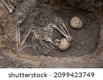 Small photo of The remains of two people were found in the ground. Skulls and bones lie in the same grave. An old crime, a sanitary burial or an echo of war.