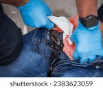 Small photo of A deep wound on the leg is treated professionally. For this purpose, the paramedic uses a hemostatic gauze. The concept is called woundpacking and comes from tactical medicine.