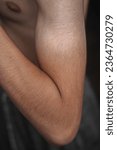 Small photo of Asian man arm tanned, tan arms, sun burn marks, tanned body, black and white arm, due to half sleeve t-shirt in sunny day, half tan body and hand, tanning, sun burn, sunburned, arm illness, arms. Hand