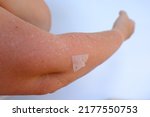 Small photo of sunburn on skin, exfoliation of epithelium, severe peeling of the skin after sunburn, hands of an elderly woman in wrinkles close-up, harmful effects of sun, concept of beauty and spa procedures