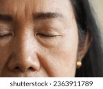 Small photo of Frown lines, sometimes called worry lines, are the vertical lines that appear between your eyebrows. They are the result of your forehead muscles squeezing inward as you furrow your brows.