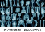 High quality x ray collection...