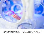 Small photo of New born premature baby girl in intensive care unit in a medical incubator under ultraviolet lamp. Phototherapy treatment to reduce bilirubin levels in newborn jaundice. Neonatal icu.
