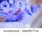 Small photo of Macro photo of doctor's hands and legs of a child. Newborn is placed in a medical incubator under ultraviolet lamp. Neonatal intensive care unit.