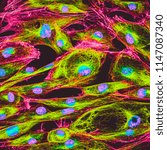 Small photo of Real fluorescence microscopic view of human skin cells in culture. Nucleus are in blue, actin filaments are in pink, tubulin was labeled with green
