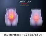 female body correction before... | Shutterstock . vector #1163876509