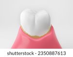 Dental calculus white teeth and gums isolated white background 3D rendering.