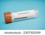 Small photo of Stool Bile Pigment Test This test measures the level of bilirubin and other bile pigments in the stool, which can be indicative of liver or gallbladder disorders.