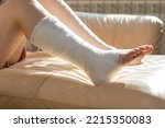 Small photo of Bandaged leg cast and toes after a running injury accident. Teen girl in a plaster cast. Cropped shot of a girl. Shin splints.