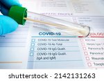 Small photo of patient nasal fluid sample tube for covid molecular test. doctor holding tube with nasal swab and requisition form for analysis of Covid-19 or coronavirus test
