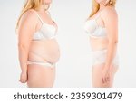 Small photo of Tummy tuck, woman's fat body before and after weight loss and liposuction on light gray studio background, plastic surgery concept