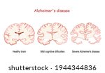 alzheimer's  is a... | Shutterstock .eps vector #1944344836
